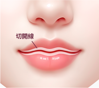 컨텐츠이미지