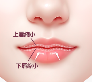 컨텐츠이미지