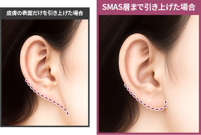 컨텐츠이미지