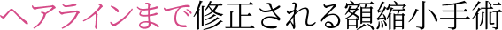 타이틀