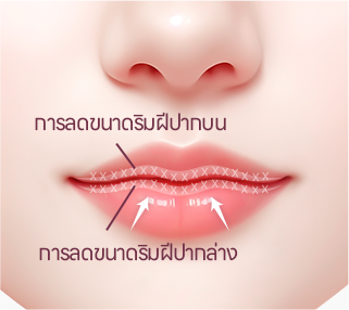 컨텐츠이미지