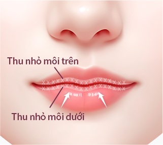 컨텐츠이미지
