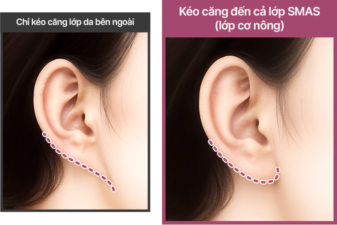 컨텐츠이미지